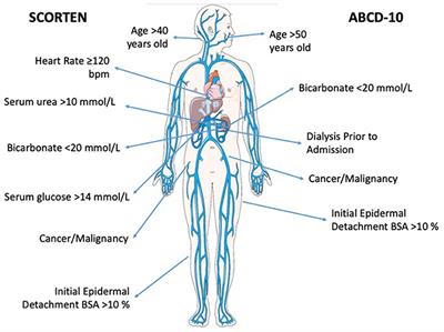 Scoring Assessments in Stevens-Johnson Syndrome and Toxic Epidermal Necrolysis